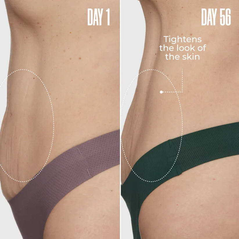 Tight-Lift Overnight Body Cream